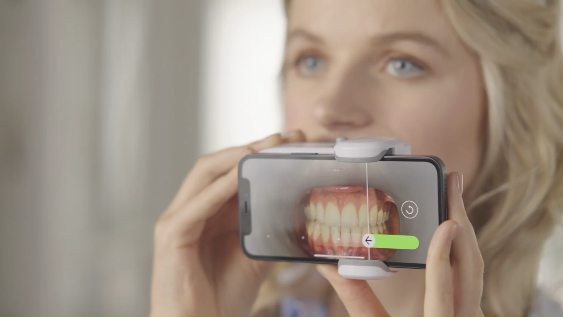 Dental Monitoring tramite smartphone