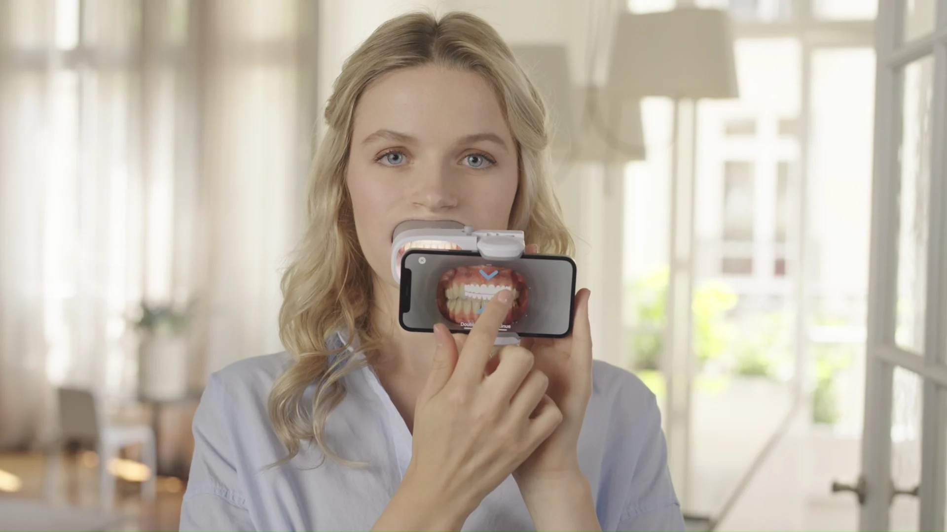 Scansione Dental Monitoring con smartphone